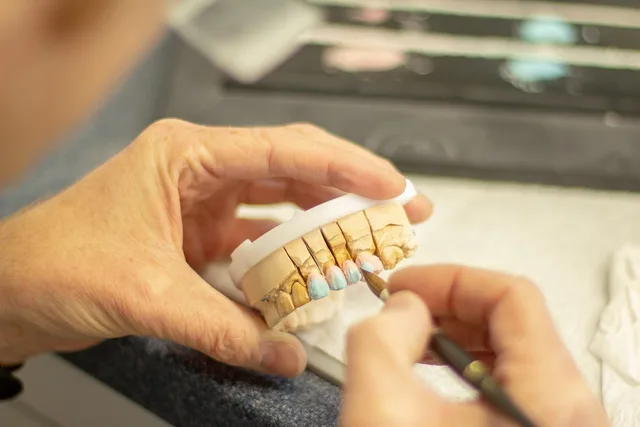 tooth replacement, dentist, healthcare, dentistry, smile, ceramic, applying, hand labor, person, clinic, equipment, brown smile, brown healthcare, dentist, dentist, dentistry, dentistry, dentistry, dentistry, dentistry. Canadian Dental Care Plan Eligibility: Proof of Coverage You Must Show
