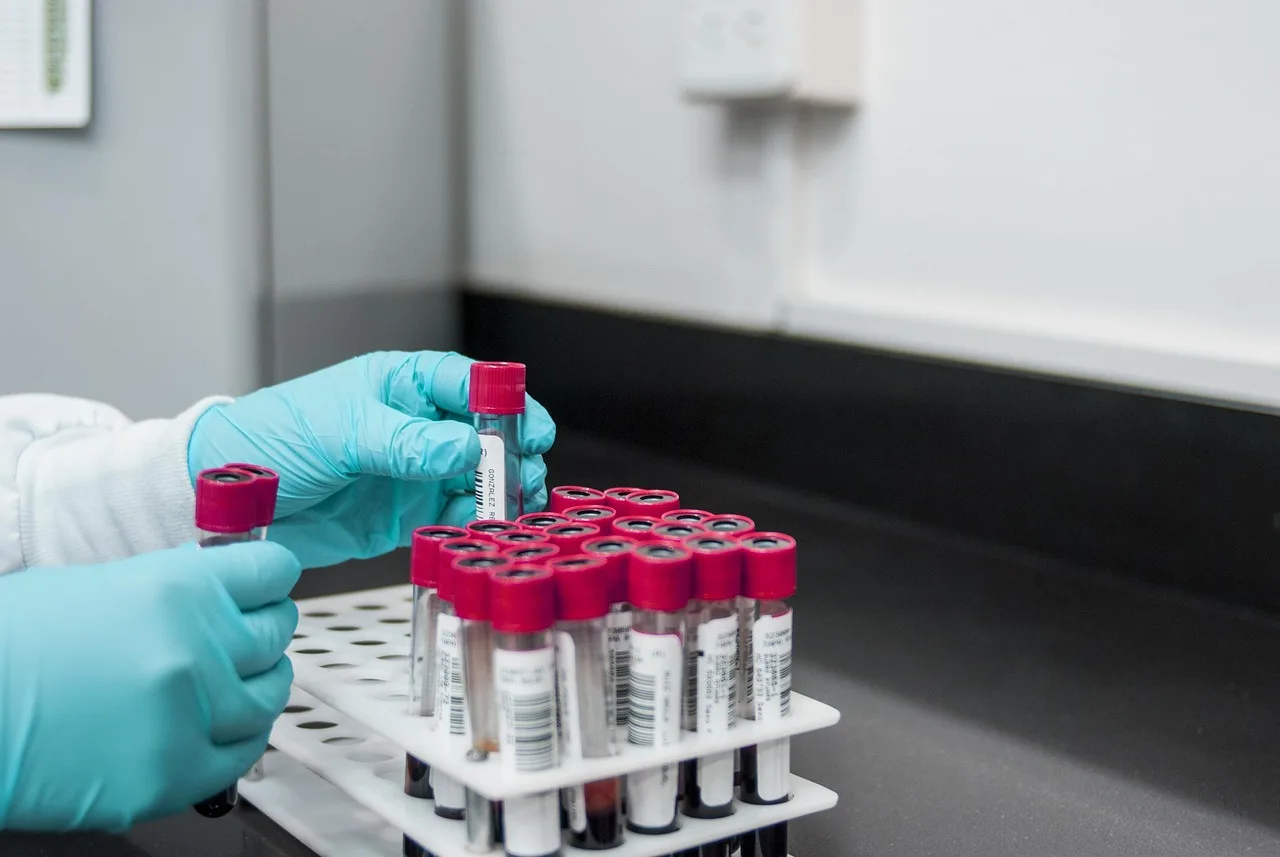 lab, experiment, test, chemistry, test tubes, laboratory, hands, gloves, surgical gloves, blood samples, lab, lab, lab, lab, lab, chemistry, laboratory, laboratory, laboratory, laboratory. Science and health reporting problems: practical fixes